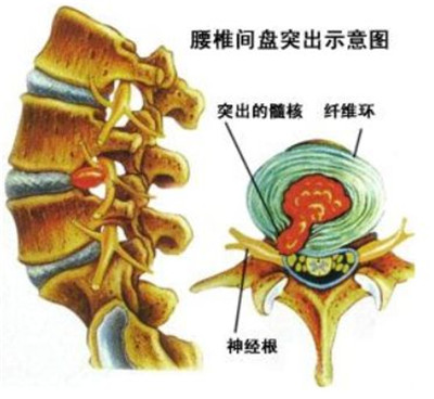 微信图片_20191122092419.jpg 微信图片_20191122092419.jpg