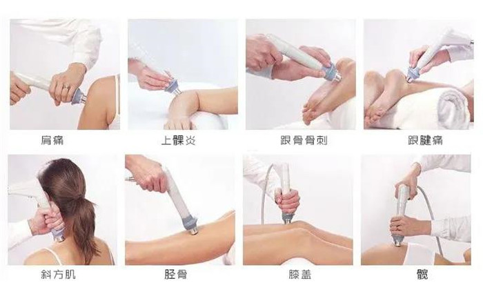 体外冲击波的临床应用1.jpg 体外冲击波的临床应用1.jpg