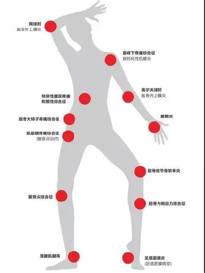 体外冲击波的临床应用2.jpg 体外冲击波的临床应用2.jpg